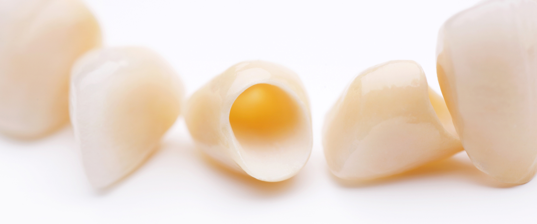 つめ物・かぶせ物